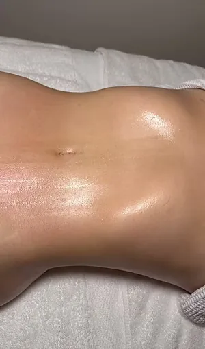body sculpting, after — result 4